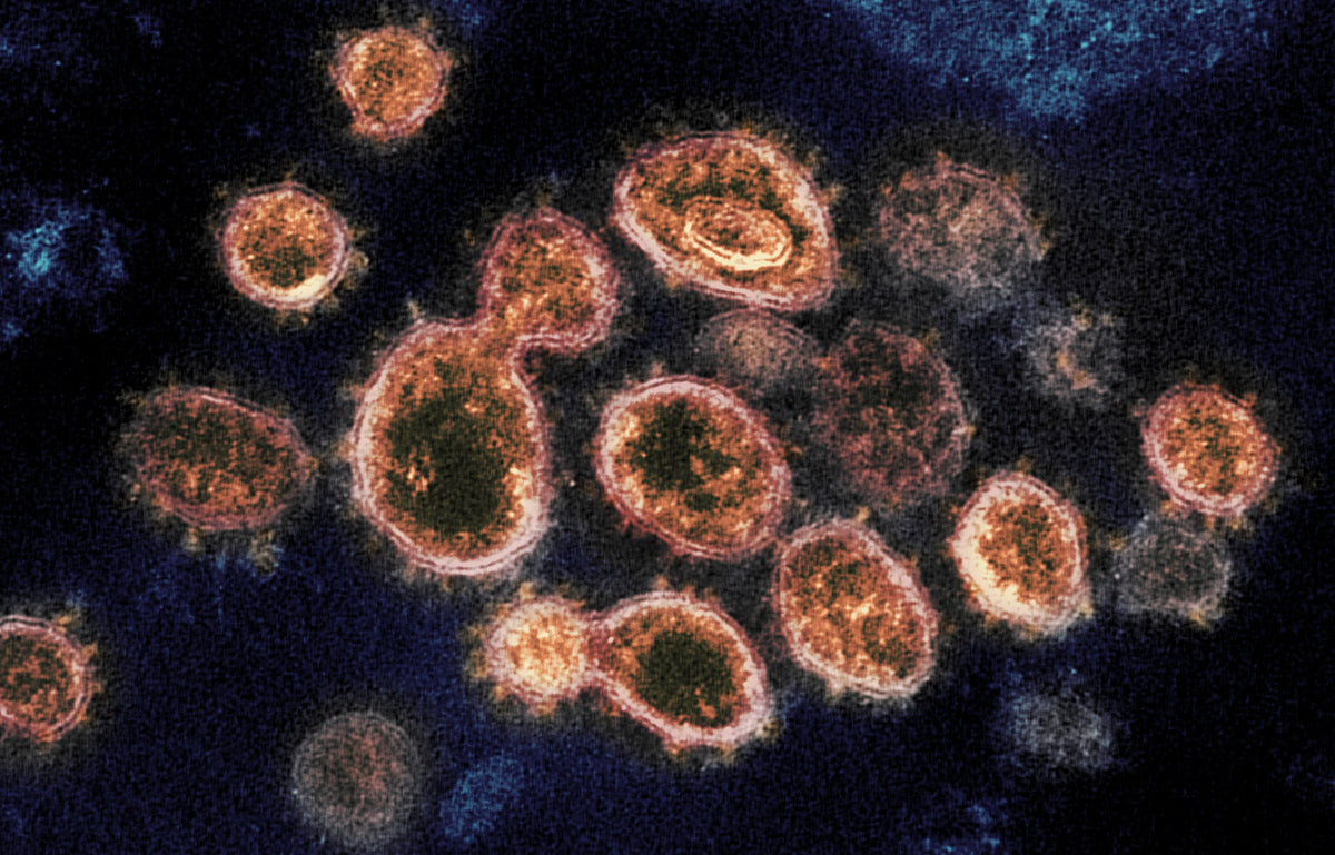 Should We Be Worried As a Society About Future COVID-19 Variants?