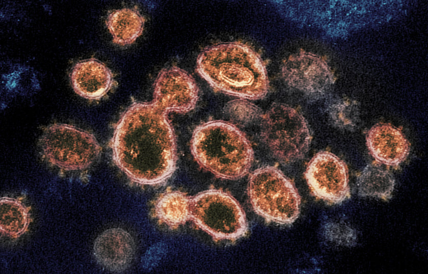 Should We Be Worried As a Society About Future COVID-19 Variants?